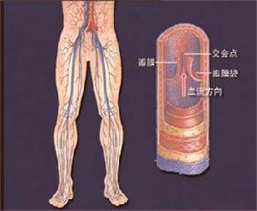 【危害】静脉瓣膜功能不全有什么危害(图1) 【危害】静脉瓣膜功能不全有什么危害(图1)