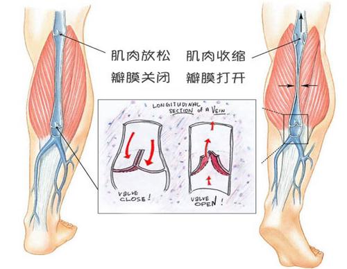 【症状】静脉瓣膜功能不全的症状(图1)